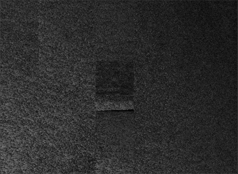 Grainy concrete texture with a small square patch
